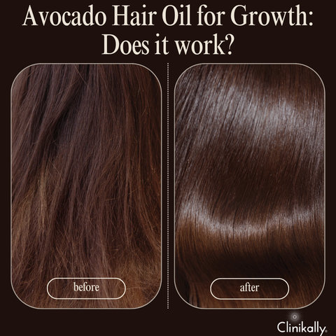 Avocado Oil for Hair Growth: Does It Work?