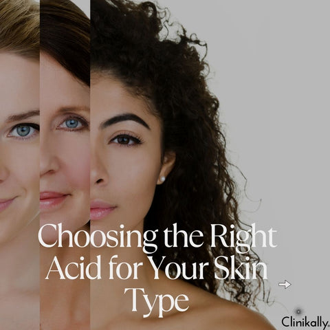 Choosing the Right Acid for Your Skin Type