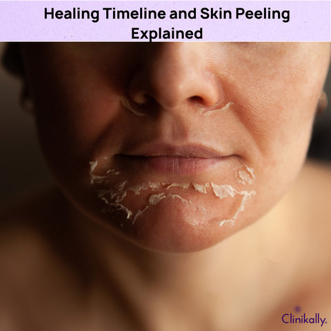 Healing Timeline and Skin Peeling Explained