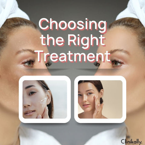 Choosing the Right Treatment