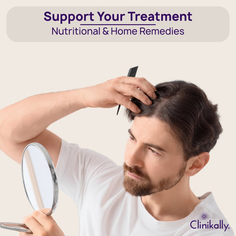 Lifestyle, Diet, and Natural Remedies for Male Pattern Baldness