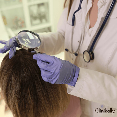 Alopecia Areata Doctor