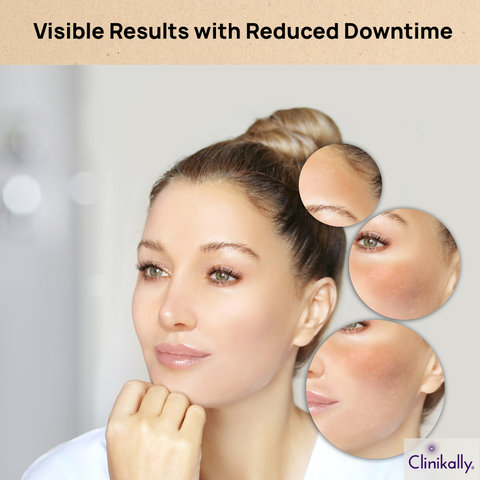 Visible Results with Reduced Downtime