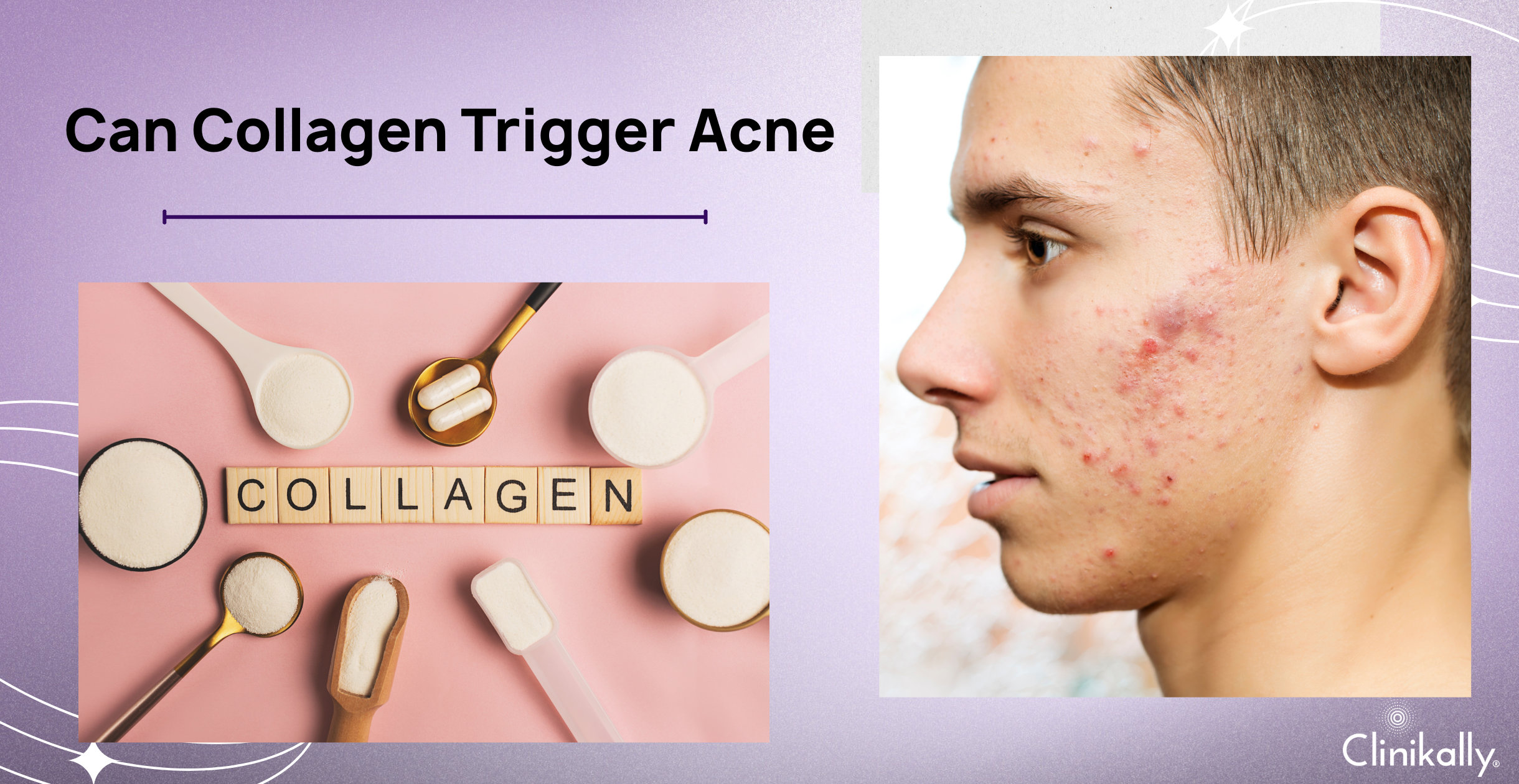 can glutathione cause acne breakout Does Taking Collagen and Breakouts? ingredient:niacinamide
