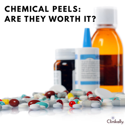 Chemical Peels: Are They Worth It?