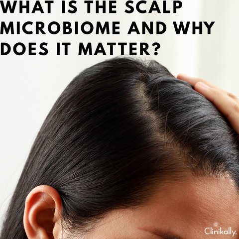 What Is the Scalp Microbiome and Why Does It Matter?