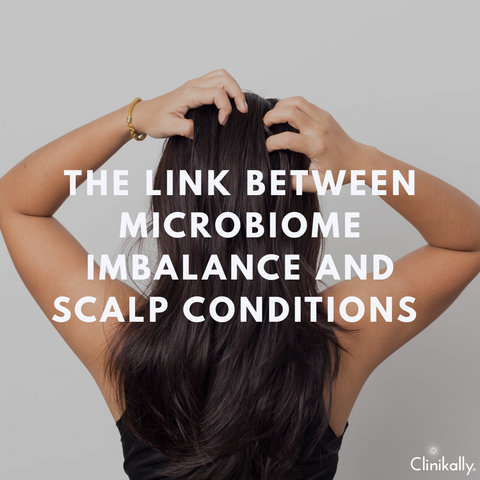 The Link Between Microbiome Imbalance and Scalp Conditions