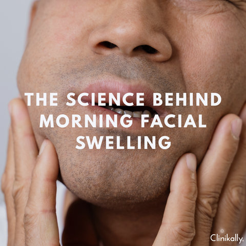 The Science Behind Morning Facial Swelling