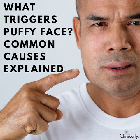What Triggers Puffy Face? Common Causes Explained
