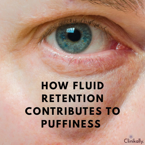How Fluid Retention Contributes to Puffiness