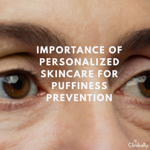 Importance of Personalized Skincare for Puffiness Prevention