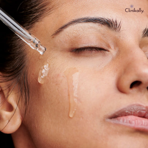 Benefits of Niacinamide For Your Skin