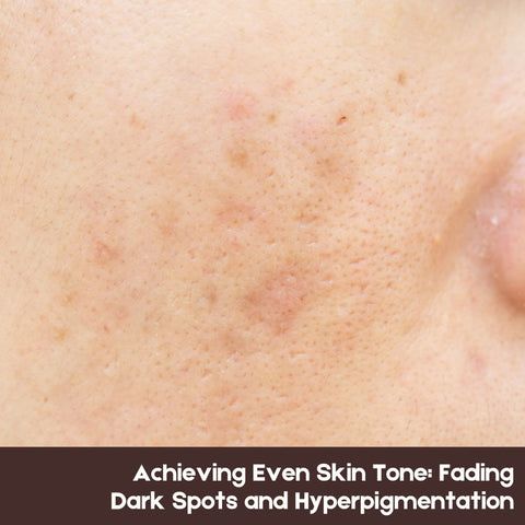 Achieving Even Skin Tone: Fading Dark Spots and Hyperpigmentation