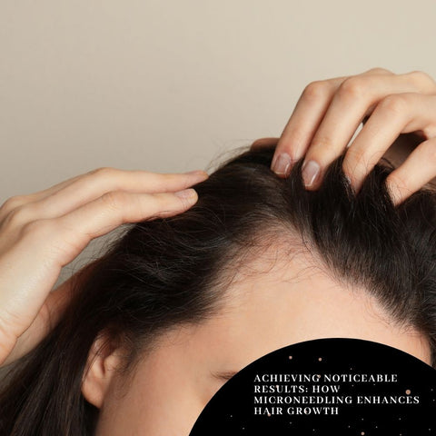 Achieving Noticeable Results: How Microneedling Enhances Hair Growth