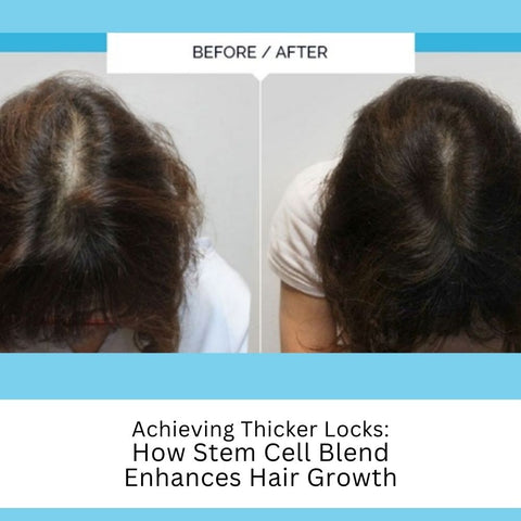 Achieving Thicker Locks: How Stem Cell Blend Enhances Hair Growth