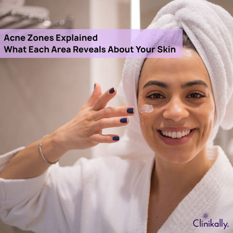 Acne Zones Explained: What Each Area Reveals About Your Skin