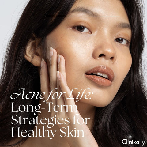 Acne for Life: Long-Term Strategies for Healthy Skin