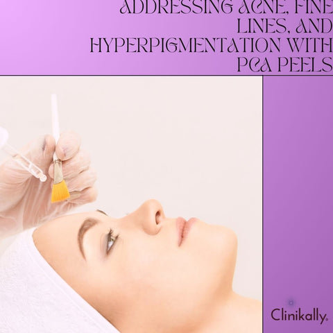 Addressing Acne, Fine Lines, and Hyperpigmentation with PCA Peels