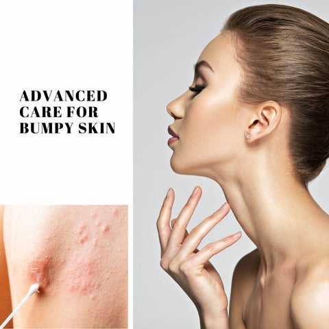 Advanced Care for Bumpy Skin