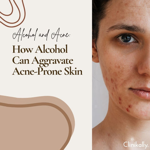 Alcohol and Acne: How Alcohol Can Aggravate Acne-Prone Skin