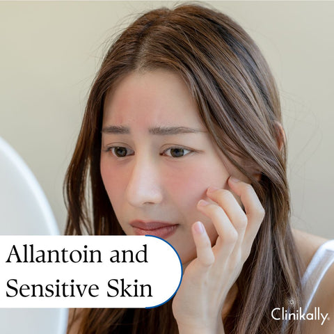 Allantoin and Sensitive Skin