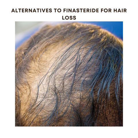 Alternatives to Finasteride for Hair Loss