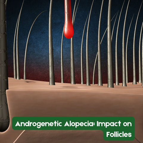 Androgenetic Alopecia: Impact on Follicles