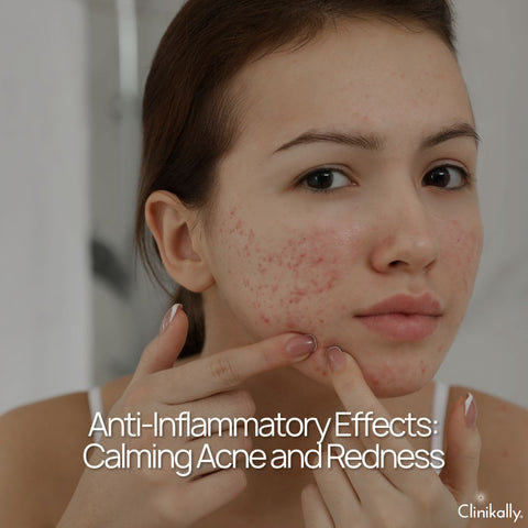 Anti-Inflammatory Effects: Calming Acne and Redness