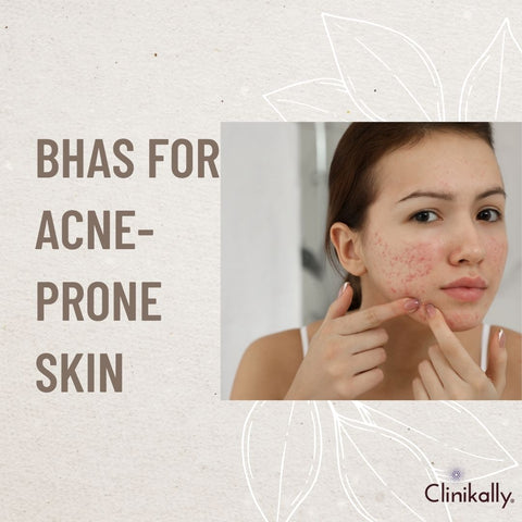 BHAs for acne-prone skin