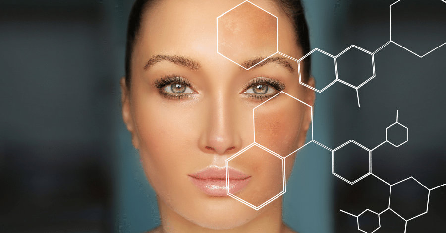 Dark Spots: Causes & Treatment - Dermatologist's Guide