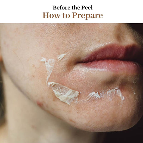 Before the Peel: How to Prepare