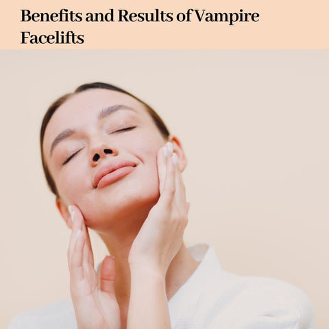 Benefits and Results of Vampire Facelifts