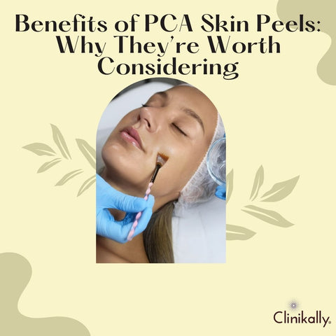 Benefits of PCA Skin Peels: Why They’re Worth Considering
