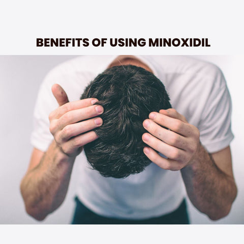 Benefits of Using Minoxidil