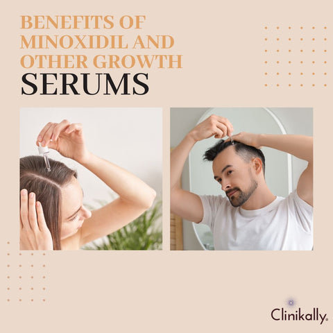 Benefits of minoxidil and other growth serums