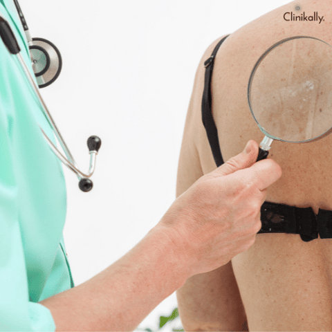 benefits of visiting a dermatologist