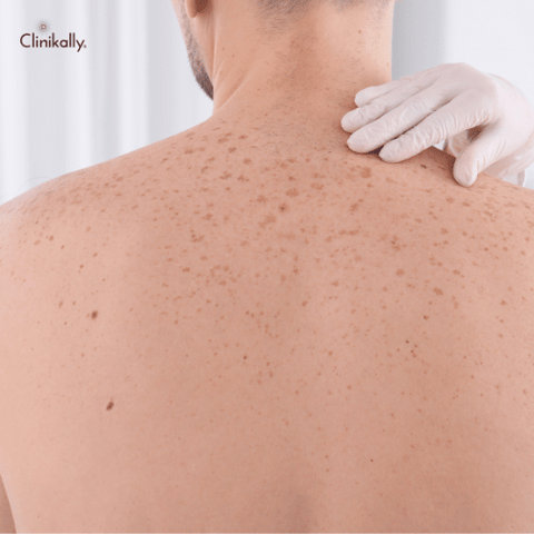 benefits of visiting a dermatologist