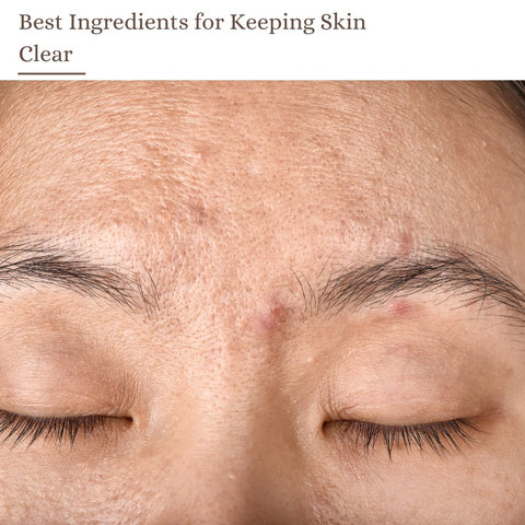 Best Ingredients for Keeping Skin Clear