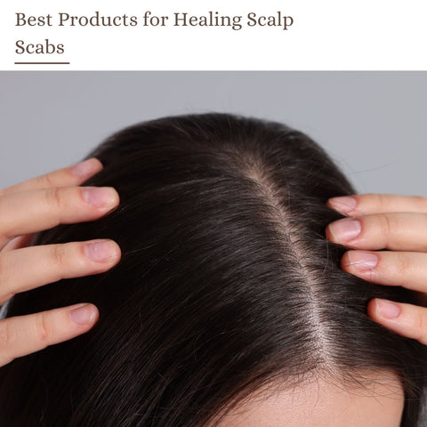 Best Products for Healing Scalp Scabs