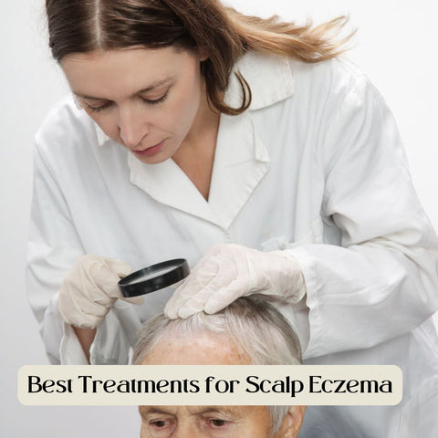 Best Treatments for Scalp Eczema