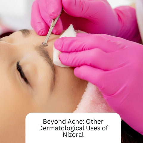 Beyond Acne: Other Dermatological Uses of Nizoral