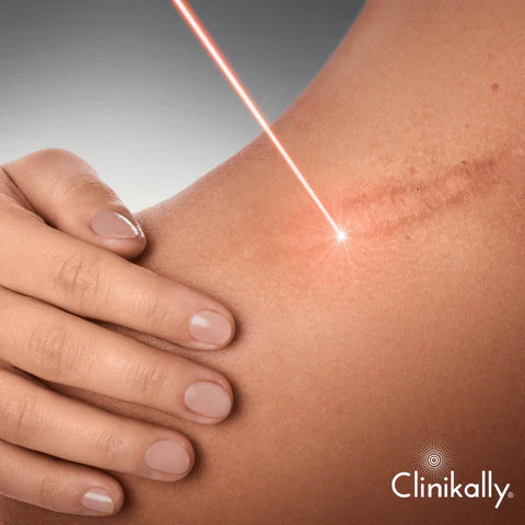 Advanced dermatological treatments for pigmentation