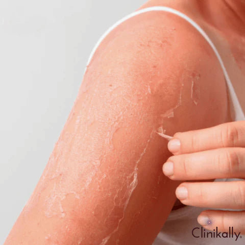 Soothes inflammation of skin