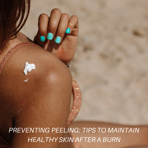 Preventing Peeling: Tips to Maintain Healthy Skin After a Burn