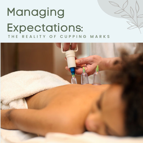 Managing Expectations: The Reality of Cupping Marks