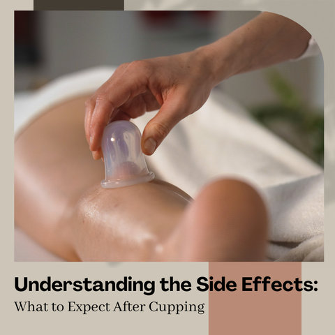 Understanding the Side Effects: What to Expect After Cupping