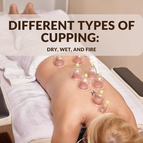 Different Types of Cupping: Dry, Wet, and Fire