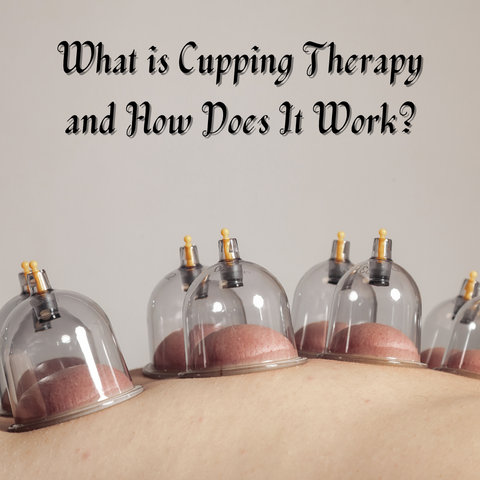 What is Cupping Therapy and How Does It Work?