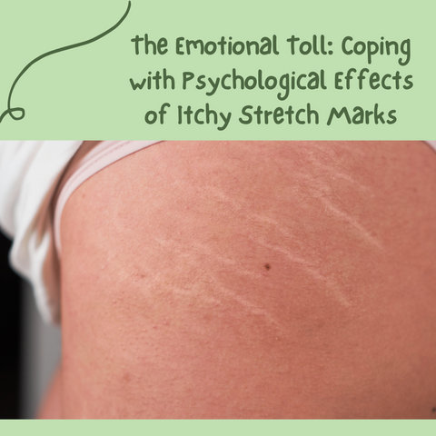 The Emotional Toll: Coping with Psychological Effects of Itchy Stretch Marks