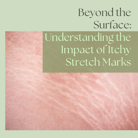 Beyond the Surface: Understanding the Impact of Itchy Stretch Marks